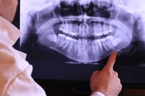 Best Chipped Tooth Repair Near Me  in Chocowinity, NC