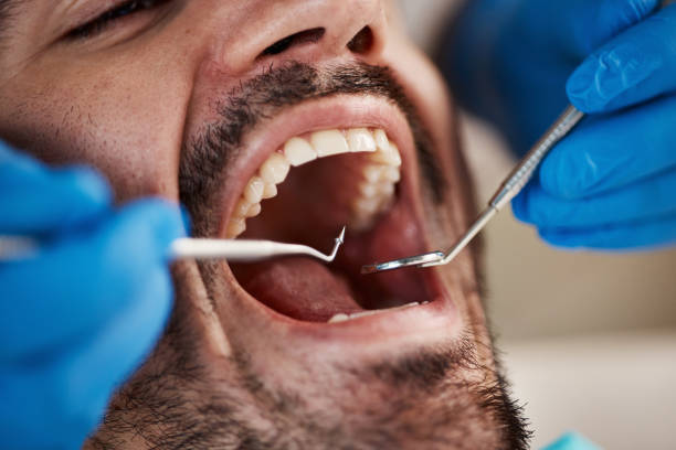 Best Emergency Gum Pain Relief  in Chocowinity, NC