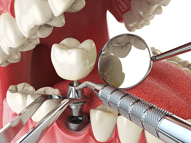 Best Urgent Tooth Repair  in Chocowinity, NC